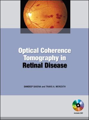 Optical Coherence Tomography