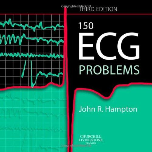 150 ECG Problems, 3e