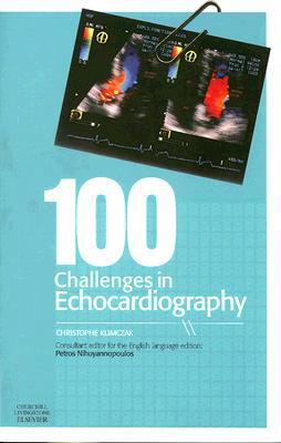 100 Challenges in Echocardiography