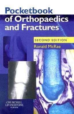 Pocketbook of Orthopaedics And Fractures 