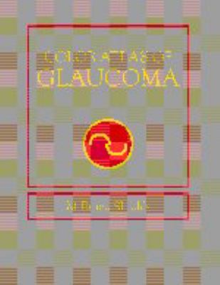 Color Atlas of Glaucoma