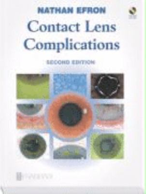 Contact Lens Complications