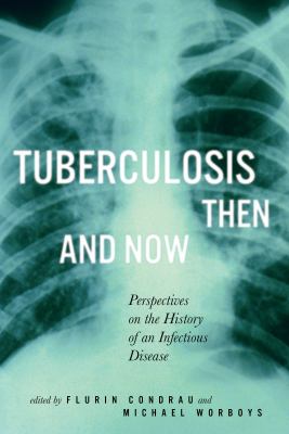 Tuberculosis Then and Now: Perspectives on the History of an Infectious Disease (Mcgill-Queen's/Associated Medical Services Studies in the History of Medicine, Health, and Society)