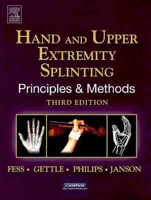 Hand Splinting Principles and Methods