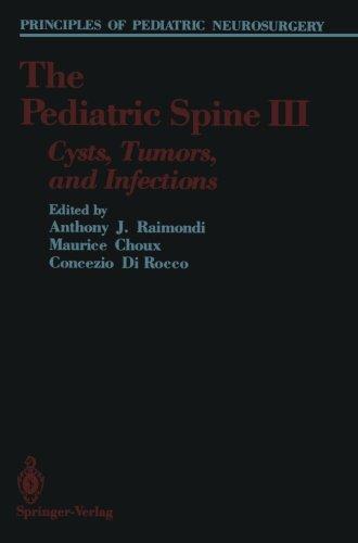 The Pediatric Spine III: Cysts, Tumors, and Infections (Principles of Pediatric Neurosurgery)