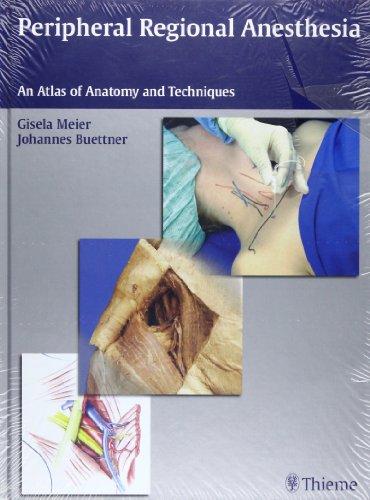 Peripheral Regional Anathesia: An Atlas of Anatomy And Techniques