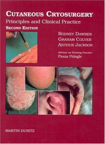 Cutaneous Cryosurgery: Principles and Clinical Practice