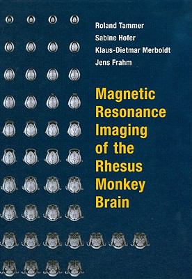 Magnetic Resonance Imaging of the Rhesus Monkey Brain