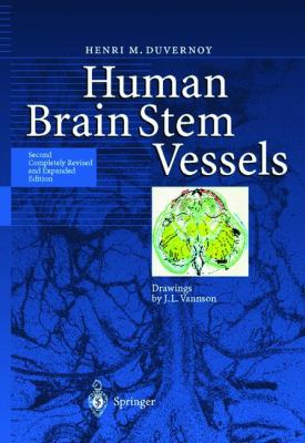 Human Brain Stem Vessels Including the Pineal Gland and Information on Brain Stem Infarction