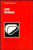 Liver Cirrhosis