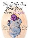 Little Boy Who Was Born Purple